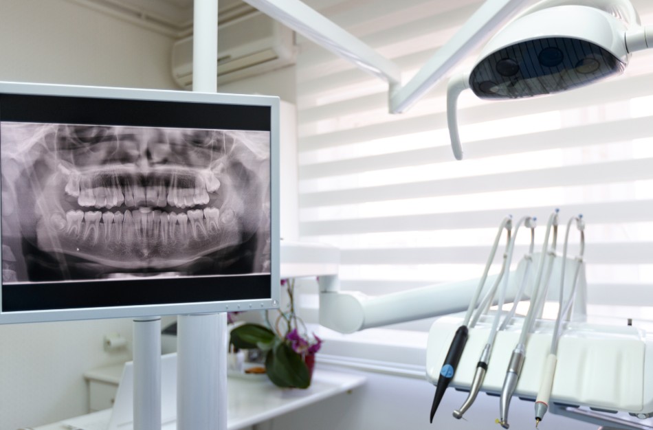 Profesionalus dantų tvarkymas: kada pakanka higienos, o kada reikia gydymo?