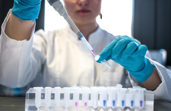 NVSC: kviečiame pasitikrinti dėl ŽIV, LPI ir virusinių hepatitų