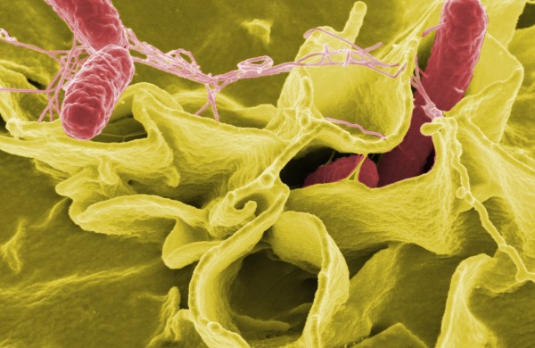 Salmonella Stanley protrūkis Europoje, atvejai registruoti ir Lietuvoje
