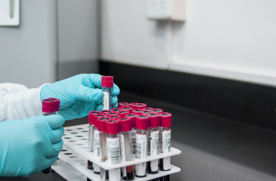 Pasaulinė hepatito diena: ankstyva diagnostika gali išgelbėti gyvybę