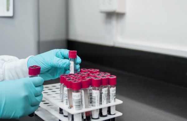 Pasaulinė hepatito diena: ankstyva diagnostika gali išgelbėti gyvybę