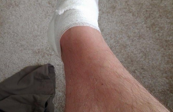 Pėsčiųjų žygyje - dvigubas rekordas: kilometrai atbulomis ir nuospaudų skaičius