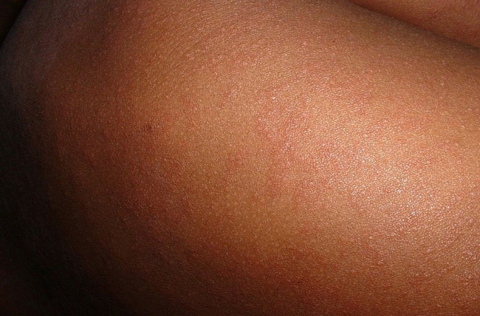 Dėmesio - Jonavoje tymai