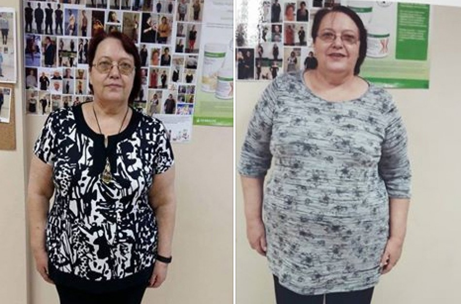 Šešiolikos kilogramų atsikračiusi jonavietė: „Dabar jau galiu pati sau nusikarpyti kojų nagus“