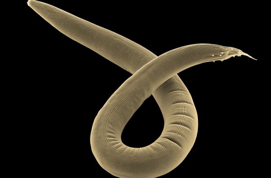 Trichineliozės negalima pamiršti - pernai buvo užregistruotas šios ligos protrūkis