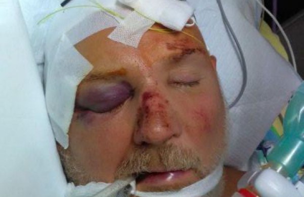    Papildoma informacija apie neatpažintą vyrą