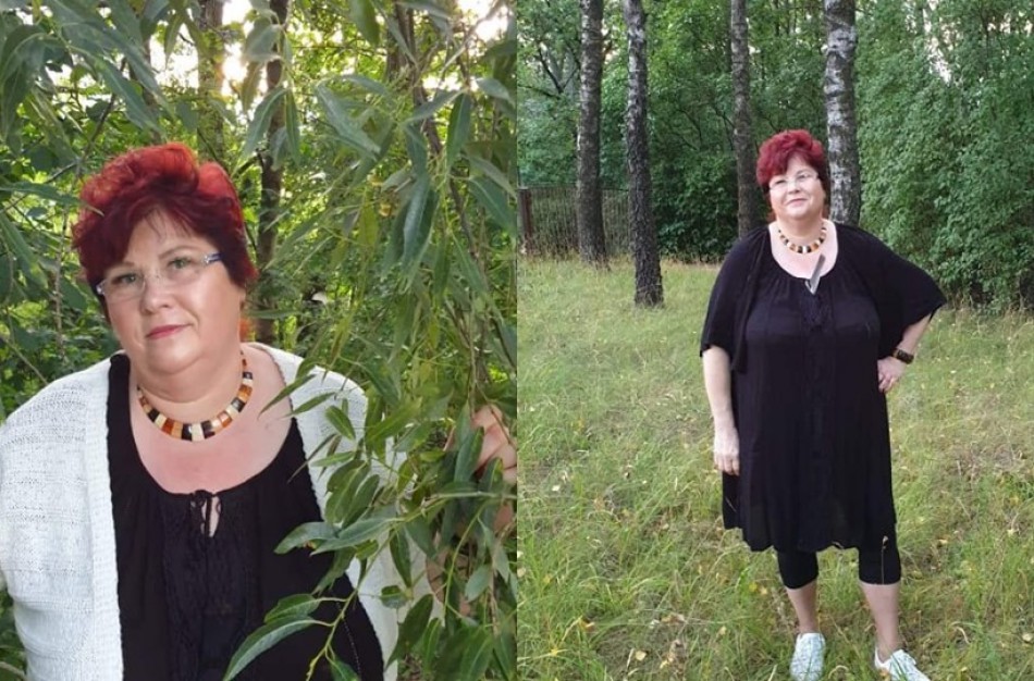 Jonavietė pataria nesižavėti skambiomis reklamomis: internetu užsakytos piliulės paguldė į ligos patalą