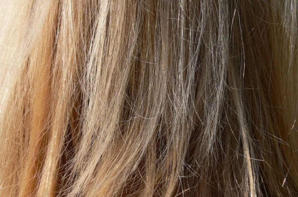 Vaikams grįžus į ugdymo įstaigas, galimas užsikrėtimo utėlėmis protrūkis