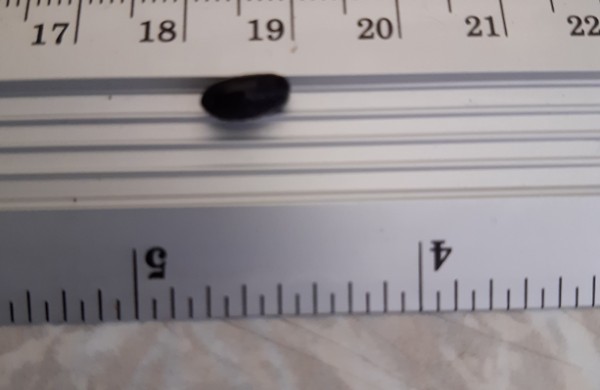 Pirmą kartą Lietuvoje identifikuota musės lerva, kuri minta žmogaus audiniais