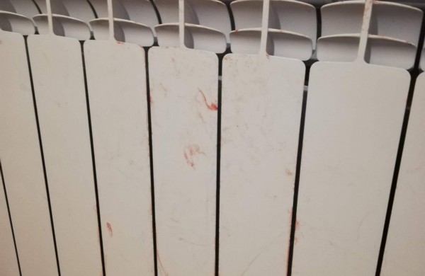 Gyventoja: naujoviški radiatoriai nesaugūs gyvūnams – užstrigusią katę laisvino gelbėtojai, jai sužalotos kojos