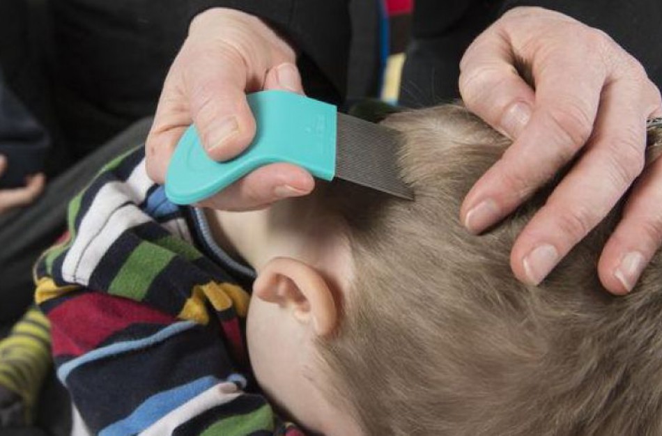 Tėvai pasipiktinę: darželyje utėlės, tačiau niekas nereaguoja?