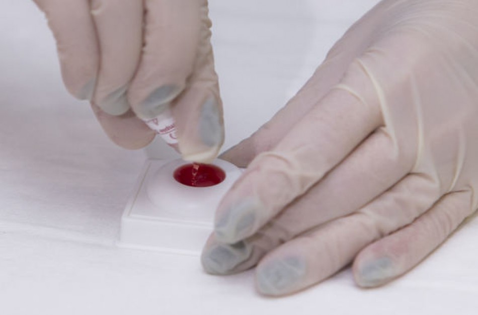 Pernai mažiau ŽIV atvejų. Dažniau plito per lytinius santykius