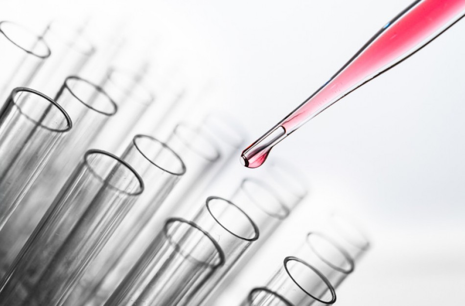 Lietuvą šiandien pasiekė dar 10 000 reagentų