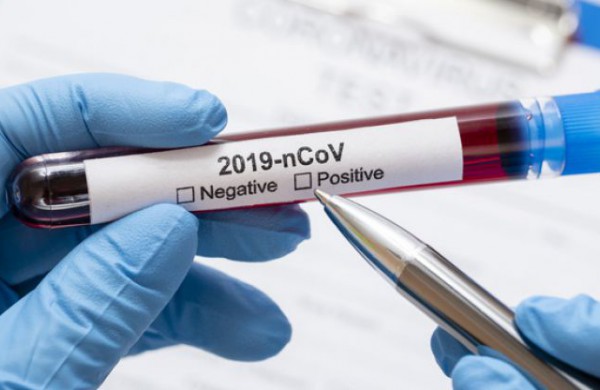 Lietuvoje patvirtinti 771 koronaviruso infekcijos atvejai, nauji - 75