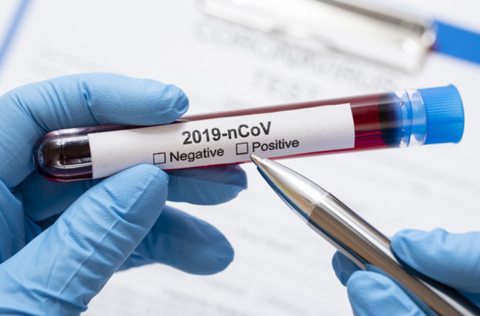 Lietuvoje patvirtinta 880 koronaviruso infekcijos atvejų, naujų - 37