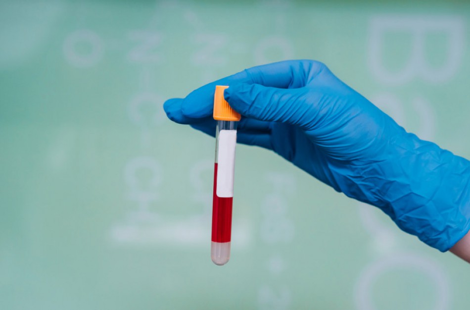 Prevenciškai dėl koronaviruso bus tiriami ir vaistininkai