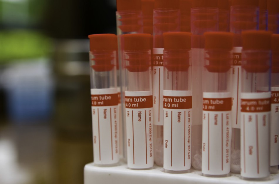 NKC: pacientams skubiai reikalingas kraujas, kviečiama padėti ekstremalioje situacijoje
