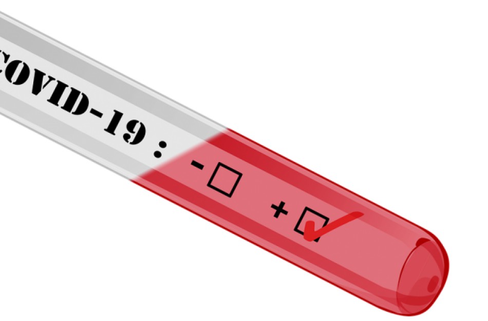 Lietuvoje patvirtinti 1505 infekcijos atvejai, naujų - 14, pasveikusių - 908