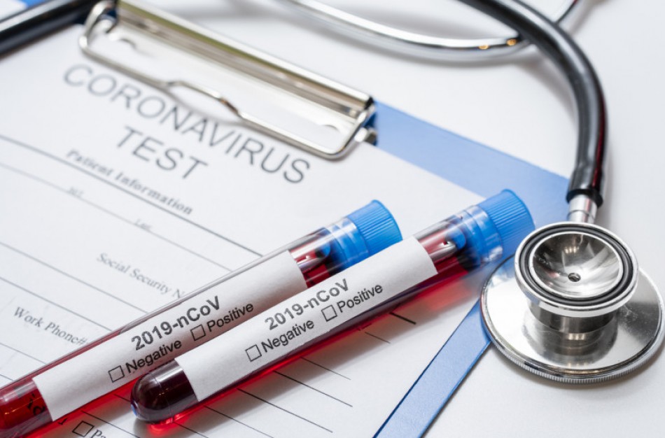 Du koronavirusu susirgusios jonaviečių šeimos nariai pasveiko, kitų dviejų laukia pakartotinis tyrimas