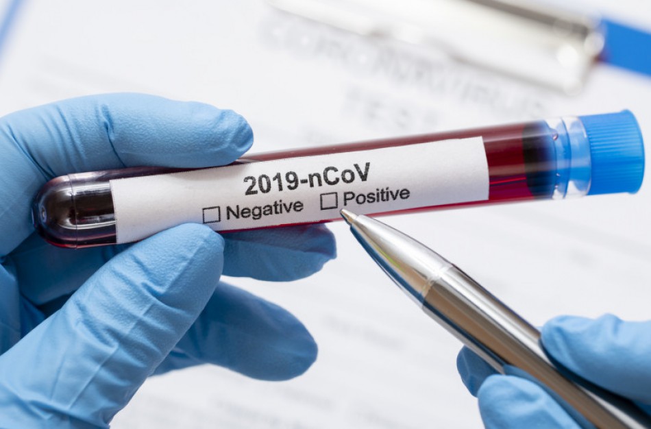 Lietuvoje – 32 koronaviruso atvejai