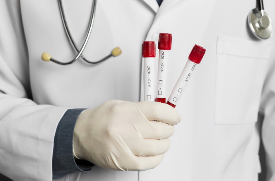 Gydymo įstaigoms perkama koronaviruso diagnostikos priemonių