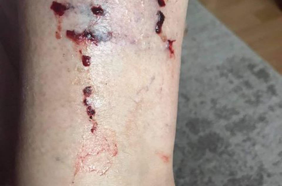 Agresyvus katinas terorizuoja daugiabučio gyventojus