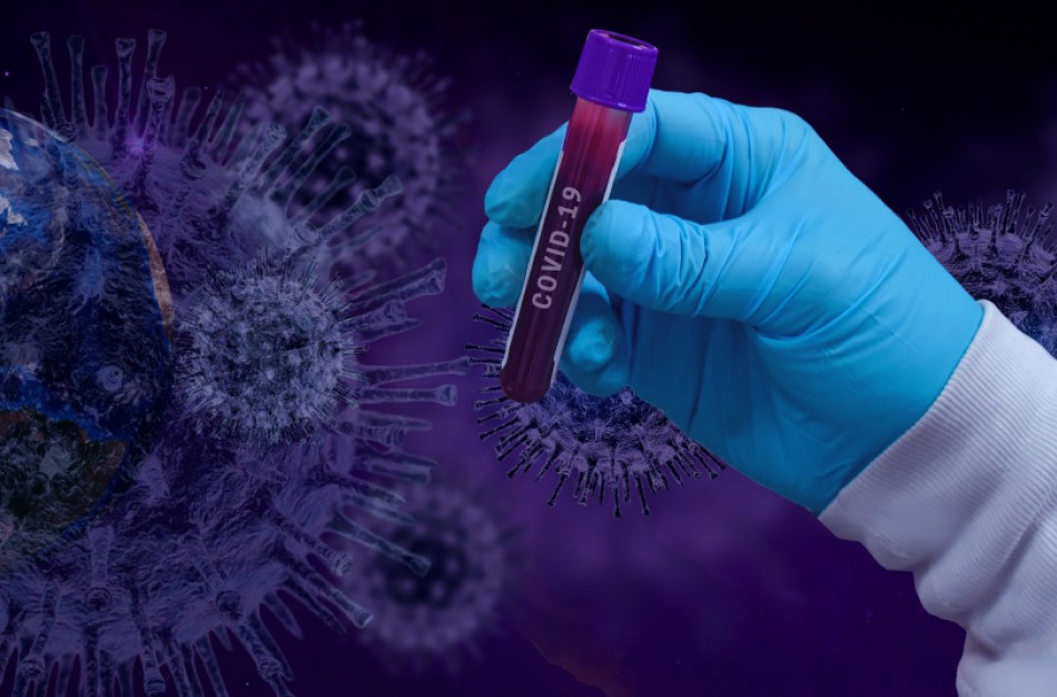 Praėjusią parą patvirtinti 1432 koronavirusinės infekcijos atvejai