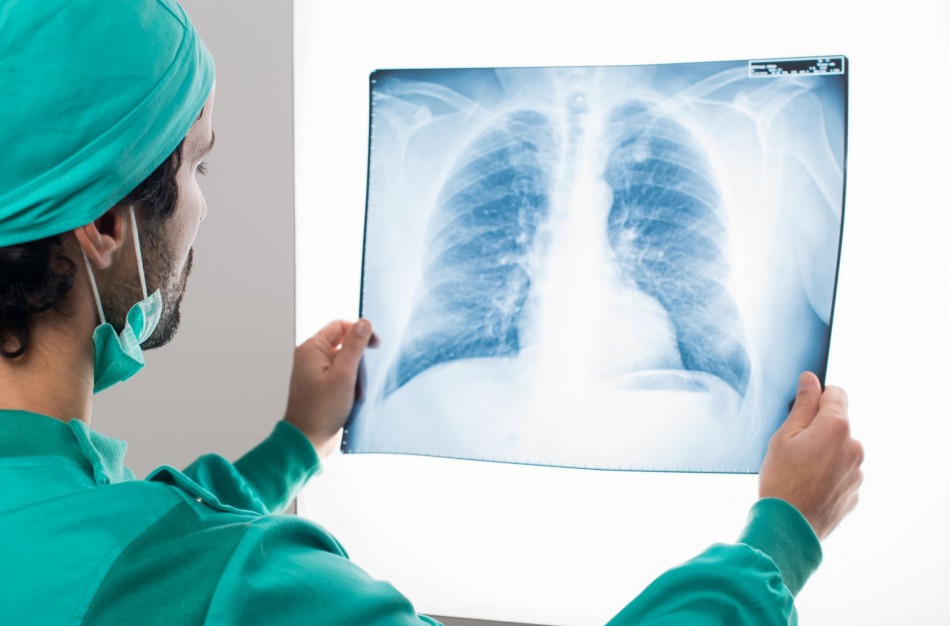 Plaučių transplantacija – išskirtinė ir labai laukiama operacija 