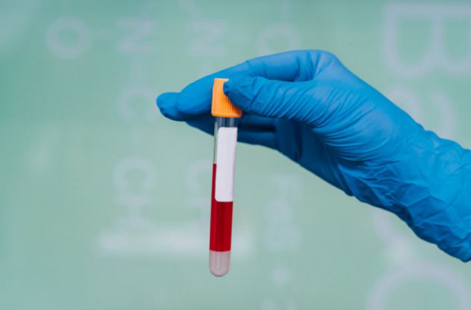 NVSC informuoja apie COVID-19 protrūkius: Jonavos rajono kepykloje - dar daugiau užsikrėtusių 