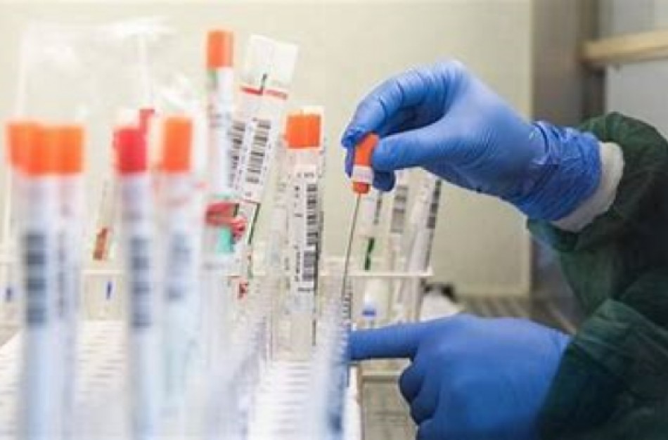 Prioritetine tvarka galės skiepytis visi pedagogai, švietimo įstaigose dirbantys darbuotojai, abiturientai, treneriai