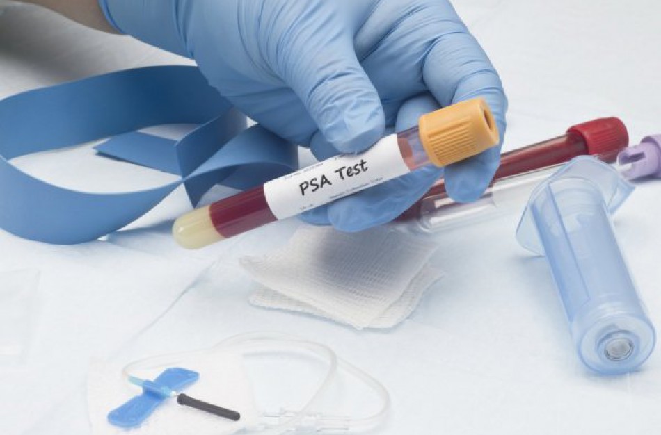 Vyrai kviečiami dalyvauti prostatos vėžio prevencinėje programoje