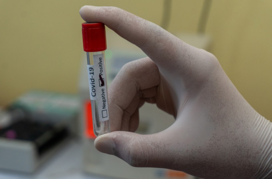 NVSC kviečia dalyvauti tyrime: tai gali suteikti gyvybiškai būtinų žinių apie COVID-19