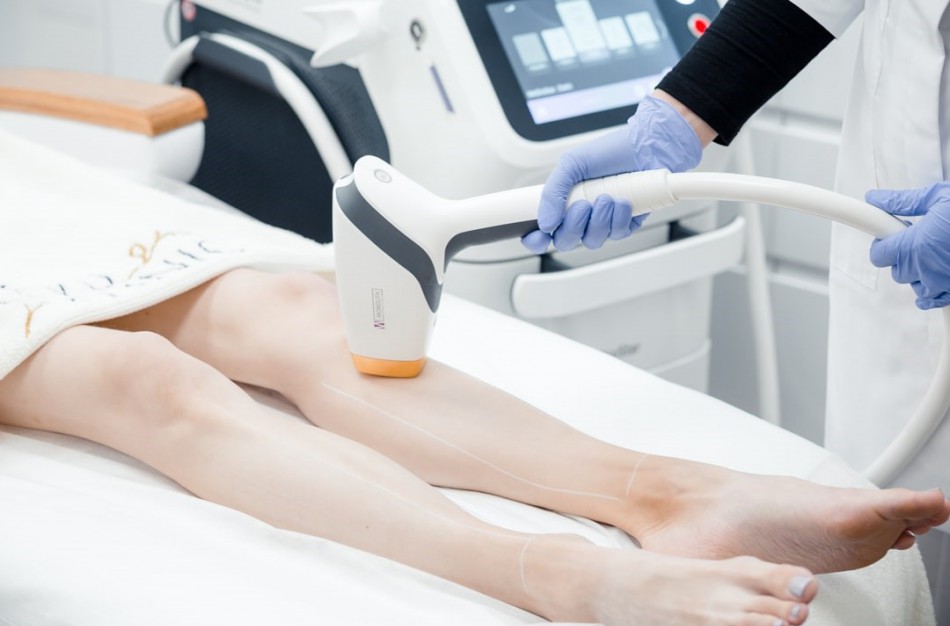 Plaukų šalinimas lazeriu – procedūros ypatumai