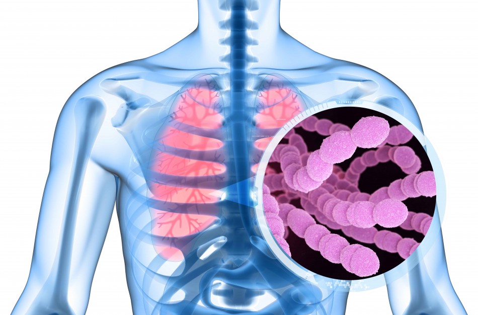 Apie pneumokoką kaip pirmokui: gydytojas atsako į svarbiausius klausimus