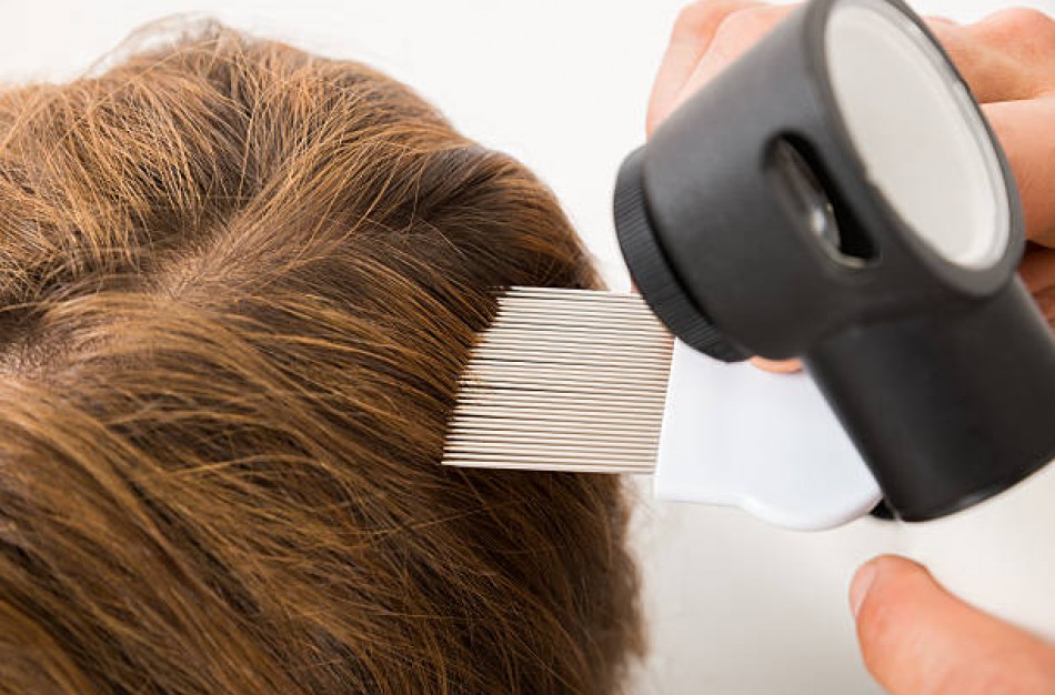 Jonavos rajone pedikuliozės atvejų neregistruota, tačiau tikrosios situacijos tai neatspindi