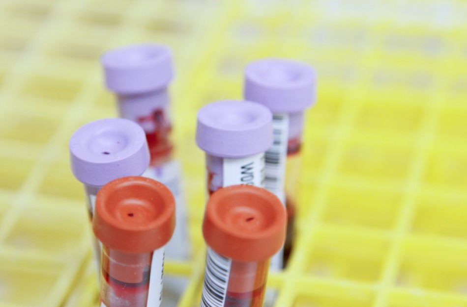 NVSC kviečia pasitikrinti dėl virusinių hepatitų, ŽIV ir lytiškai plintančių infekcijų