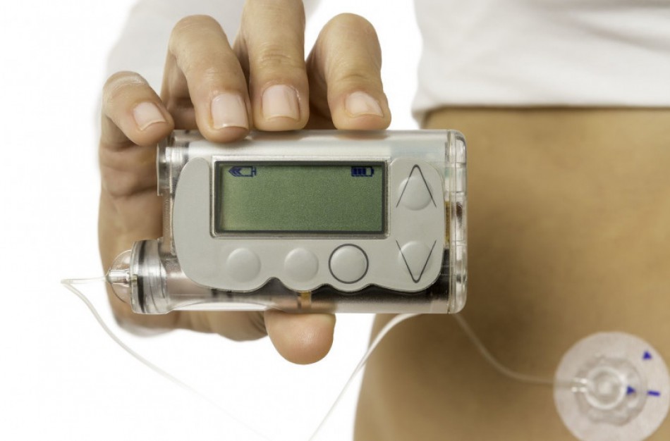 Gerėja insulino pompų nuomos prieinamumas: papildomai skirs arti milijono